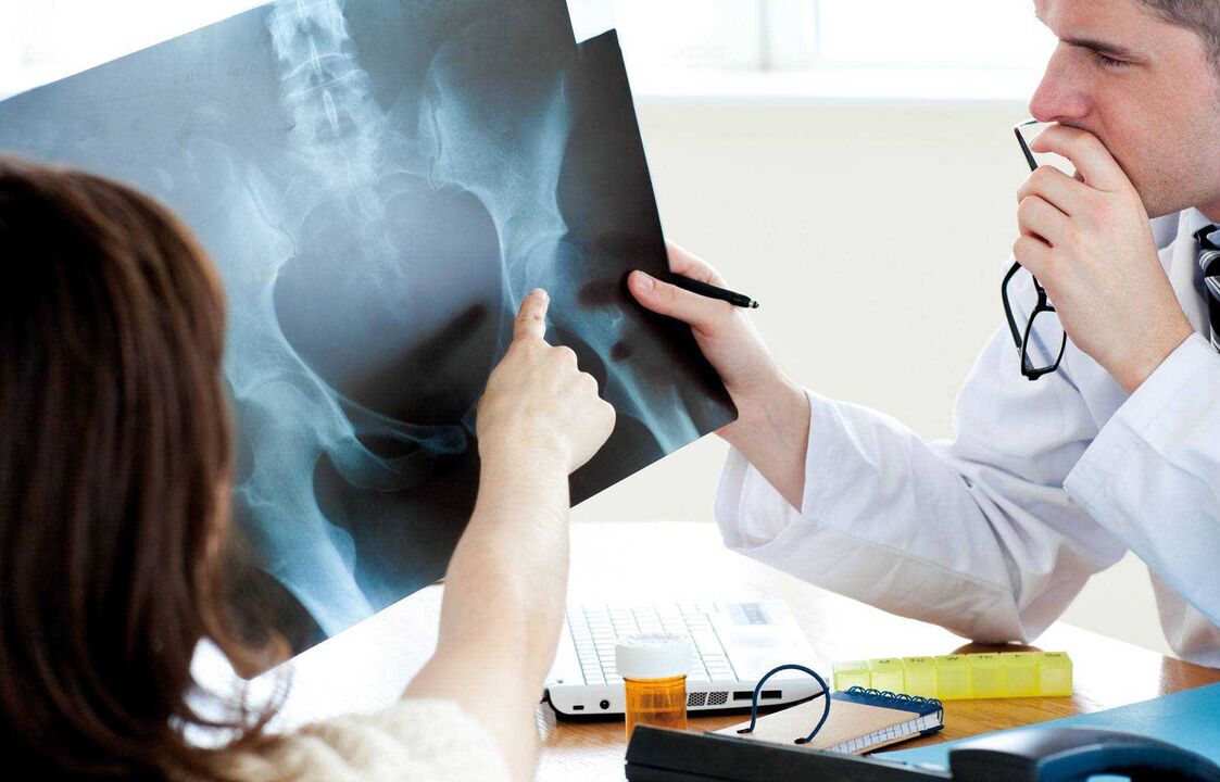 doctors examining x-ray for hip osteoarthritis