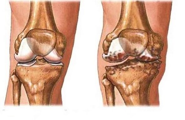 Healthy and sore by the joints